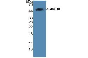 Detection of Recombinant LEP, Human using Polyclonal Antibody to Leptin (LEP)