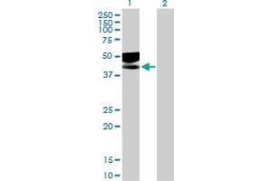 Western Blot analysis of IL1R2 expression in transfected 293T cell line by IL1R2 MaxPab polyclonal antibody. (IL1R2 anticorps  (AA 1-398))