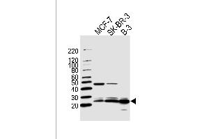 Western blot analysis of lysates from MCF-7, SK-BR-3, B-3 cell line (from left to right), using C13orf30 Antibody (C-term) (ABIN1944729 and ABIN2838567). (C13orf30 anticorps  (C-Term))