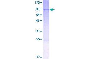 Image no. 1 for Flavin Containing Monooxygenase 3 (FMO3) (AA 1-532) protein (GST tag) (ABIN1354250)