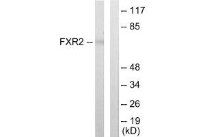 Western blot analysis of extracts from COLO205 cells, using FXR2 antibody. (FXR2 anticorps  (C-Term))