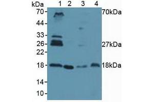 Figure. (UBE2I anticorps  (AA 33-158))
