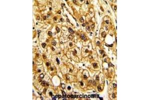 Immunohistochemistry (IHC) image for anti-Integrin, alpha X (Complement Component 3 Receptor 4 Subunit) (ITGAX) antibody (ABIN3002913)