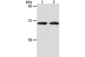 Western Blot analysis of Human liver cancer and fetal kidney tissue using ACOT11 Polyclonal Antibody at dilution of 1:650 (ACOT11 anticorps)