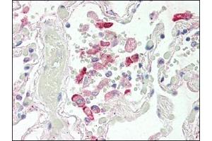Image no. 1 for anti-Carboxylesterase 1 (CES1) (Internal Region) antibody (ABIN372769) (CES1 anticorps  (Internal Region))