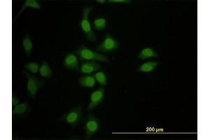 Immunofluorescence of monoclonal antibody to HNF4A on HeLa cell.