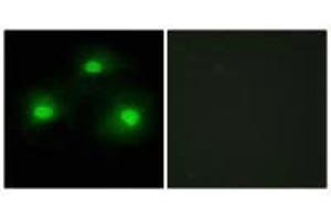 Immunofluorescence analysis of HeLa cells, using TPD52 antibody. (PKIA anticorps)
