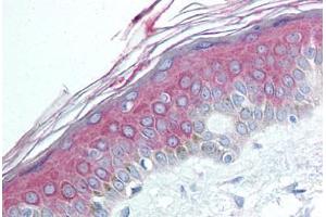 Human Skin (formalin-fixed, paraffin-embedded) stained with HDAC4 antibody ABIN292441 at 1:50 followed by biotinylated goat anti-rabbit IgG secondary antibody ABIN481713, alkaline phosphatase-streptavidin and chromogen. (HDAC4 anticorps  (N-Term))