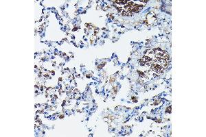 Immunohistochemistry of paraffin-embedded rat lung using G Rabbit pAb (ABIN6129931, ABIN6137010, ABIN6137011 and ABIN6217659) at dilution of 1:100 (40x lens).