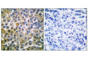Immunohistochemistry (IHC) image for anti-SMAD, Mothers Against DPP Homolog 1 (SMAD1) (Ser465) antibody (ABIN1847896)