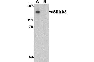 Western Blotting (WB) image for anti-SLIT and NTRK-Like Family, Member 5 (SLITRK5) (Middle Region 1) antibody (ABIN1031190)