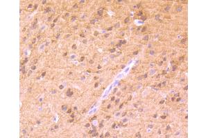 Paraformaldehyde-fixed, paraffin embedded mouse brain tissue, Antigen retrieval by boiling in sodium citrate buffer (pH6) for 15min, Block endogenous peroxidase by 3% hydrogen peroxide for 30 minutes, Blocking buffer (normal serum) at 37°C for 20min, Antibody incubation with PKC alpha(T638) (4B3) Monoclonal Antibody  at 1:50 overnight at 4°C, followed by a conjugated secondary and DAB staining. (PKC alpha anticorps  (pThr638))