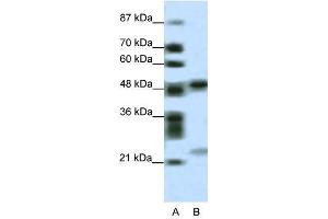 PHF11 antibody used at 0. (PHF11 anticorps  (Middle Region))