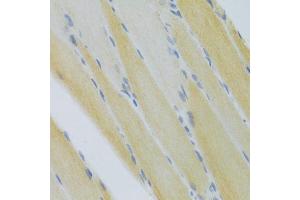 Immunohistochemistry of paraffin-embedded mouse skeletal muscle using CXCR3 Antibody (ABIN5971514) at dilution of 1/100 (40x lens). (CXCR3 anticorps)
