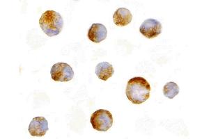 Immunohistochemistry (IHC) image for anti-Induced Myeloid Leukemia Cell Differentiation Protein Mcl-1 (MCL1) (N-Term) antibody (ABIN1031455) (MCL-1 anticorps  (N-Term))