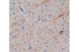 Used in DAB staining on fromalin fixed paraffin- embedded Kidney tissue