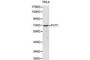 Western Blotting (WB) image for anti-Protection of Telomeres 1 (POT1) (AA 497-634) antibody (ABIN5663924) (POT1 anticorps  (AA 497-634))