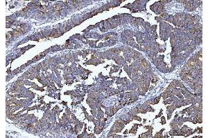 IHC analysis of Tryptophan Hydroxylase/TPH1 using anti-Tryptophan Hydroxylase/TPH1 antibody (ABIN7601556).