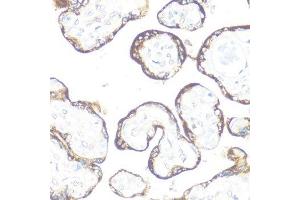 Immunohistochemistry of paraffin-embedded human placenta using FGFR2 antibody. (FGFR2 anticorps  (AA 1-100))