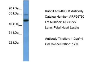 WB Suggested Anti-IQCB1  Antibody Titration: 0. (IQCB1 anticorps  (C-Term))