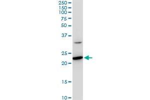 SEC22B monoclonal antibody (M03), clone 5A10. (SEC22B anticorps  (AA 1-110))