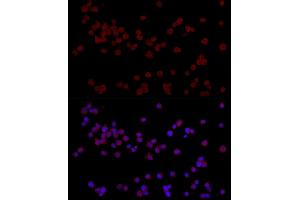 Immunofluorescence analysis of Jurkat cells using CTIP2/BCL11B Rabbit pAb (ABIN7265808) at dilution of 1:50 (40x lens).