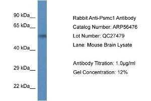 Western Blotting (WB) image for anti-Proteasome (Prosome, Macropain) 26S Subunit, ATPase, 1 (PSMC1) (C-Term) antibody (ABIN2774148)