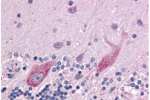 Human Brain, cerebellum: Formalin-Fixed, Paraffin-Embedded (FFPE) (DPF2 anticorps  (AA 56-155))