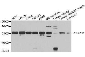 Western blot analysis of extracts of various cell lines, using ANXA11 antibody. (Annexin A11 anticorps  (AA 276-505))