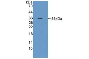 Western blot analysis of recombinant Human ICAM3. (ICAM-3/CD50 anticorps  (AA 259-491))