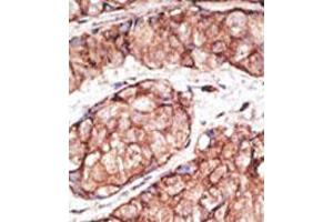 Image no. 2 for anti-Toll-Like Receptor 5 (TLR5) (N-Term) antibody (ABIN357051) (TLR5 anticorps  (N-Term))