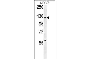 RABG Antibody (N-term) 0460a western blot analysis in MCF-7 cell line lysates (35 μg/lane). (RABGAP1 anticorps  (N-Term))