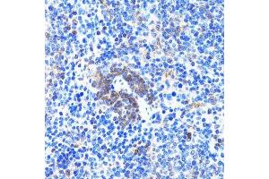 Immunohistochemistry of paraffin-embedded rat spleen using ACTR2 antibody. (ACTR2 anticorps  (AA 1-160))