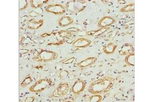 Immunohistochemistry of paraffin-embedded human kidney tissue using ABIN7160986 at dilution of 1:100 (NDUFS1 anticorps  (AA 80-290))