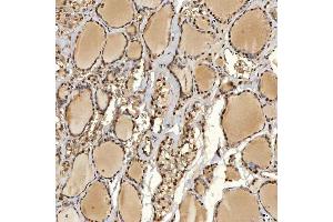 IHC analysis of SNRPD2 using anti-SNRPD2 antibody (ABIN7598963). (SNRPD2 anticorps  (AA 1-118))