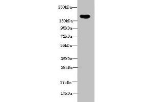 Western blot All lanes: ADAMTS7 antibody at 2 μg/mL + Mouse brain tissue Secondary Goat polyclonal to rabbit IgG at 1/10000 dilution Predicted band size: 184 kDa Observed band size: 184 kDa