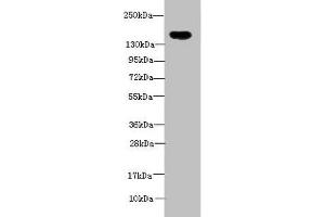 Western blot All lanes: ADAMTS7 antibody at 2 μg/mL + Mouse brain tissue Secondary Goat polyclonal to rabbit IgG at 1/10000 dilution Predicted band size: 184 kDa Observed band size: 184 kDa (ADAMTS7 anticorps  (AA 242-593))