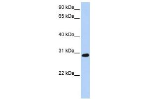 WB Suggested Anti-XBP1 Antibody Titration: 0. (XBP1 anticorps  (C-Term))
