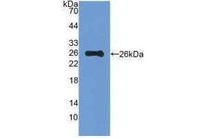 Western blot analysis of recombinant Mouse MUC5B. (MUC5B anticorps  (AA 75-295))