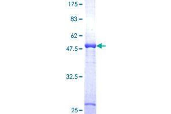 DCXR Protein (AA 1-244) (GST tag)