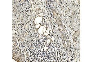 IHC analysis of Aldolase/ALDOA using anti-Aldolase/ALDOA antibody (ABIN7601908). (ALDOA anticorps  (AA 50-364))