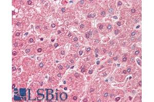 ABIN571255 (5µg/ml) staining of paraffin embedded Human Liver. (ALDH6A1 anticorps  (AA 262-272))