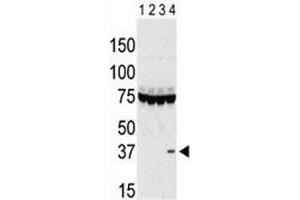 Western blot testing of Aurora-C antibody and lysate of 293 cells expressing 1) Flag tag, 2) Flag-tagged -A, 3) -B and 4) Aurora-C. (Aurora Kinase C anticorps  (AA 115-145))