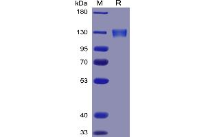 Human Protein, mFc Tag on SDS-PAGE under reducing condition.