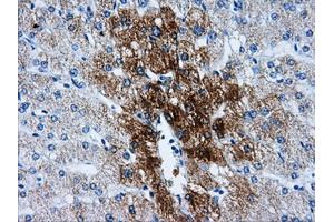 Immunohistochemical staining of paraffin-embedded liver tissue using anti-HSD17B10mouse monoclonal antibody. (HSD17B10 anticorps)