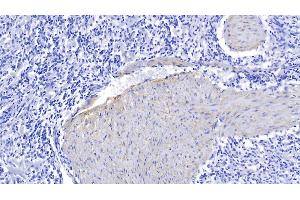 Detection of ELN in Human Spleen Tissue using Polyclonal Antibody to Elastin (ELN)