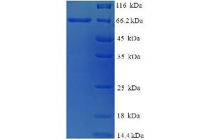 SDS-PAGE (SDS) image for Cysteine Conjugate-beta Lyase 2 (CCBL2) (AA 1-454), (full length) protein (His-SUMO Tag) (ABIN5711433)