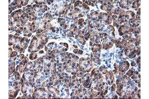 Image no. 3 for anti-Ribophorin 1 (RPN1) antibody (ABIN1500749)