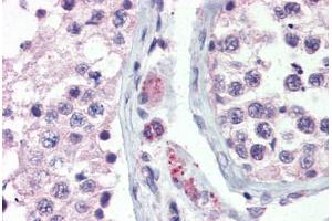 Anti-GPR98 antibody  ABIN1048902 IHC staining of human testis.