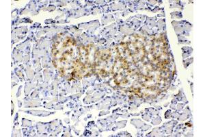 IHC analysis of IGFBP1 using anti-IGFBP1 antibody .